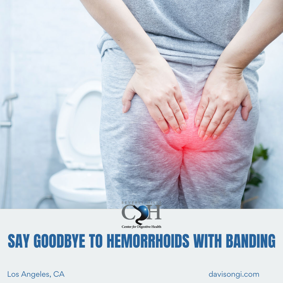 Say Goodbye to Hemorrhoids with Banding