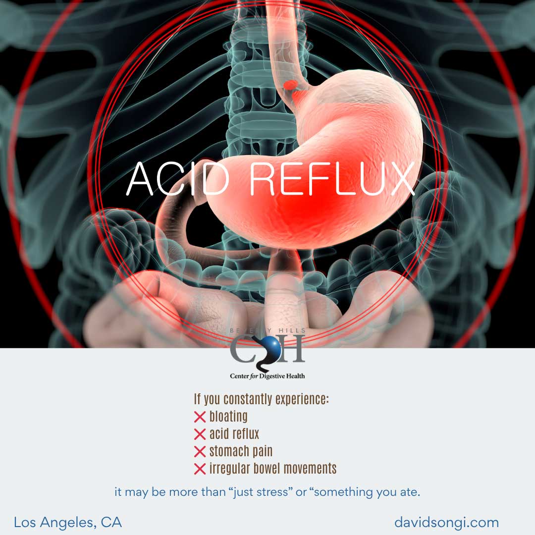 Acid Reflux - It May be More than Just Stress or Something You Ate