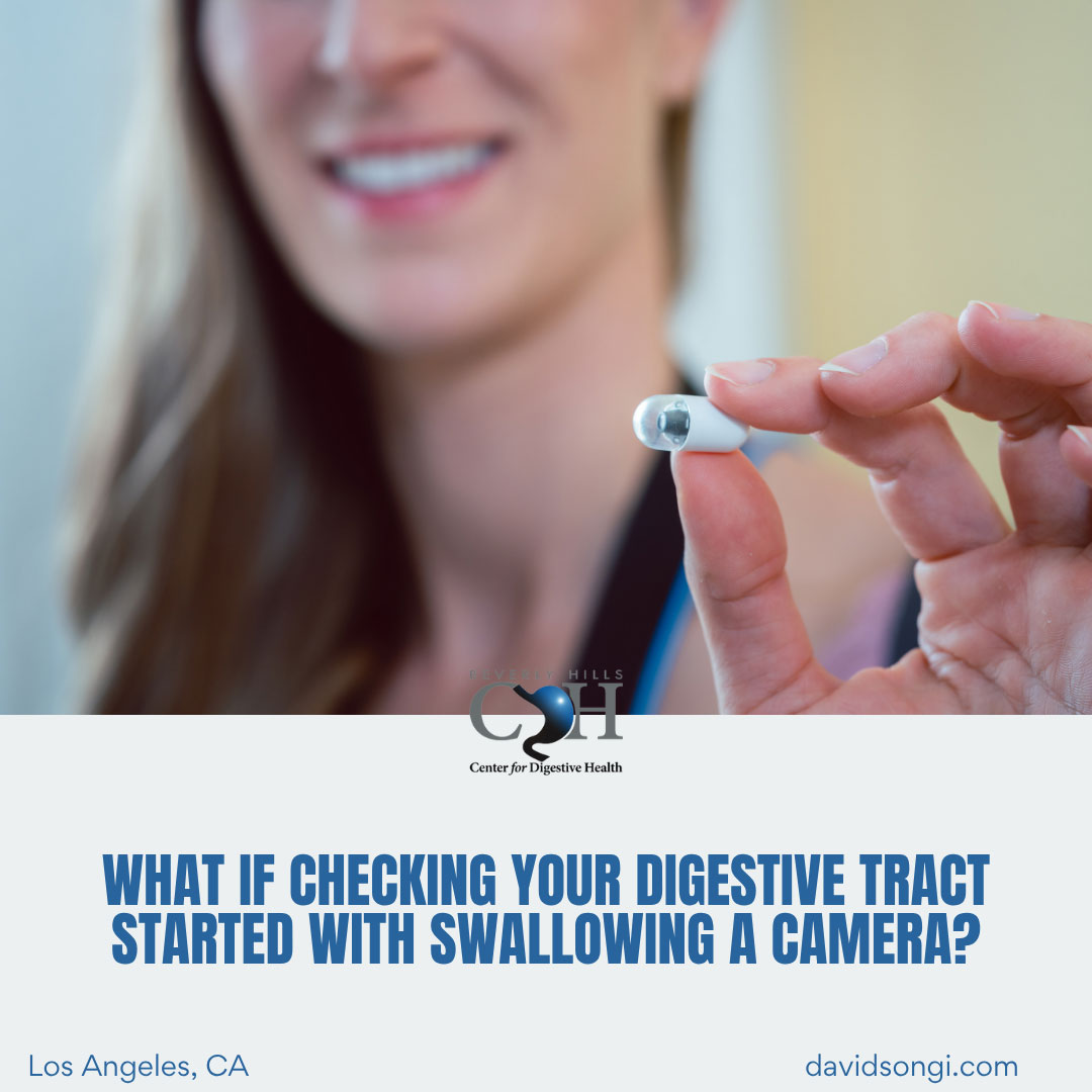 Checking Your Digestive Tract Starts with a Camera